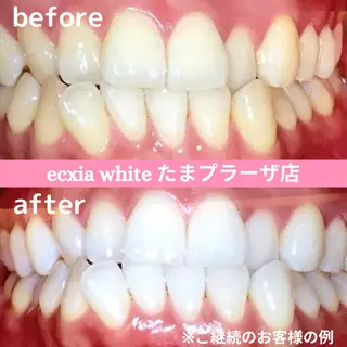 セルフホワイトニング エクシアたまプラーザ店所属・セルフホワイトニング エクシアたまプラーザのその他イメージ
