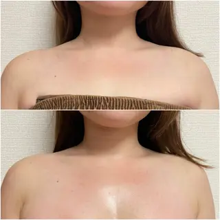 透明感の肌Lino malieのエステ・リラクイメージ