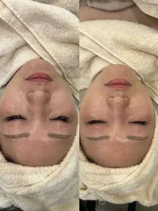 エステサロンTug高知駅前店所属・Tug 高知駅前店/ NANAMI🌐のエステ・リラクイメージ