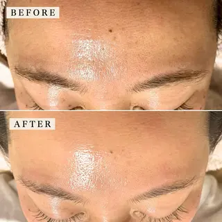 【産毛・眉毛ケア＆肌質改善サロン】＊BiBi＊beautysalon所属・眉･産毛専門BiBi 糸脱毛スレッティングのエステ・リラクイメージ