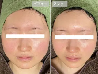 SlowGarden 体質肌質改善サロンのエステ・リラクイメージ