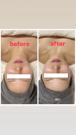 フェイシャルサロン ultimateのエステ・リラクイメージ