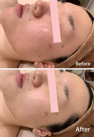 レイビス盛岡店 ♡吉田♡のエステ・リラクイメージ