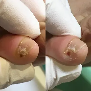 東京巻き爪アカデミー所属・東京巻き爪 アカデミーのエステ・リラクイメージ