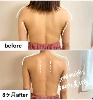 育乳痩身バストアップサロン　つばききよら所属・育乳痩身バストアップ サロン　つばききよらのエステ・リラクイメージ