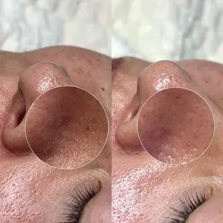 Suu.千種/今池 毛穴洗浄/韓国肌管理のエステ・リラクイメージ