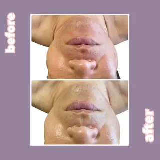 【痩身・脱毛サロン】 REBISKIN🌱のエステ・リラクイメージ