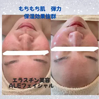 beauty SalonRcoinのマツエク・マツパデザイン