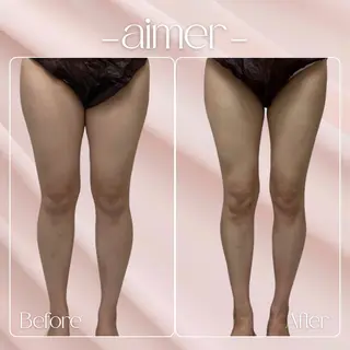 aimer 島田のエステ・リラクイメージ