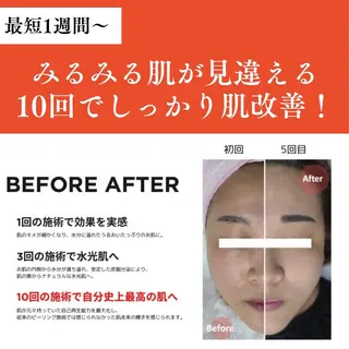 眉と肌の専門店　-STORY-所属・眉と肌の専門店 STORYのエステ・リラクイメージ