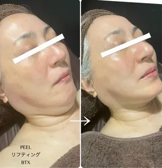 Total Beauty salon Bloom所属・肌育WISHpro 専門サロンBloomのエステ・リラクイメージ