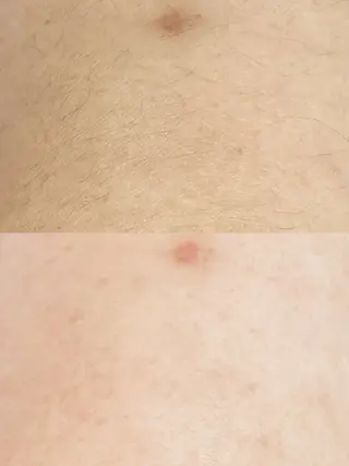 Hit. シュガーリング豊橋のエステ・リラクイメージ