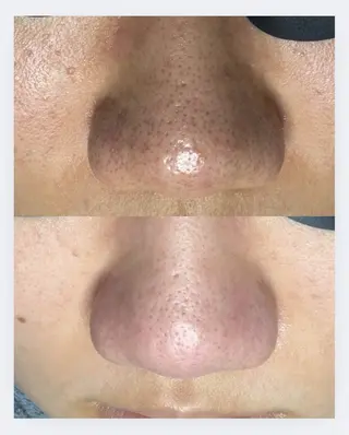 beauty salon N.11所属・beauty salonN.11のエステ・リラクイメージ