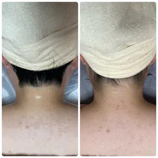 脱毛サロン エクボスタッフのエステ・リラクイメージ