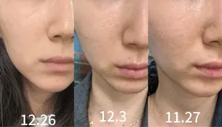 ネイル aliaハイフ&水光ジェットサロン所属・aliaハーブ水光店 エステティシャン募集のエステ・リラクイメージ