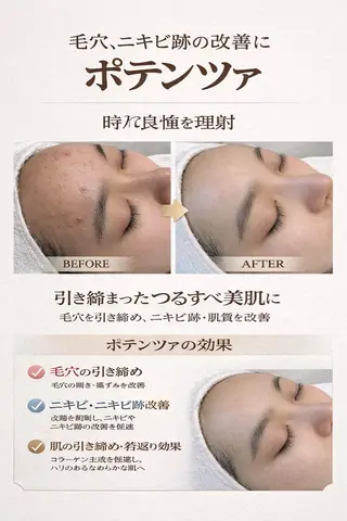 マツエク・マツパ 愛維美水光美肌専門店所属・愛維美水光美肌専門店 メンズレディースokのエステ・リラクイメージ