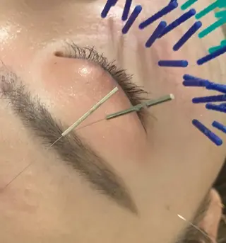 表参道鍼灸院K 美容鍼🔮ララピールのエステ・リラクイメージ