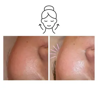 ニキビ/敏感肌/乾燥 Lilyauraのエステ・リラクイメージ