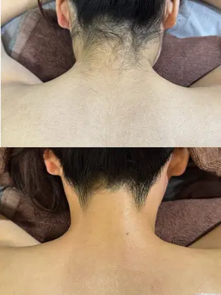 ワックス脱毛サロン 🎀新宿駅徒歩5分のエステ・リラクイメージ