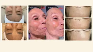 医療提携Beauty SalonMuseのエステ・リラクイメージ