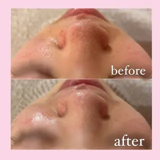 韓国肌管理専門店 White labo 宝塚店所属・有川 凜のエステ・リラクイメージ