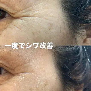 ナリスデアイム　　西宮所属・ナリス　デアイム西宮 辻　江梨那のエステ・リラクイメージ