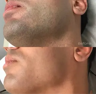 メンズ トータルビューティー サロンワンダーのマツエク・マツパデザイン