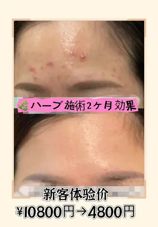 西区九条エステ MITUREIサロンのエステ・リラクイメージ