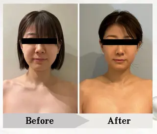 BAUM坂戸 ヘッドスパのエステ・リラクイメージ