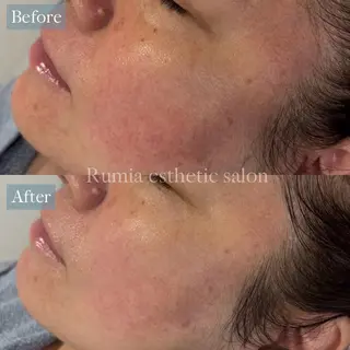 Rumia Salonのエステ・リラクイメージ