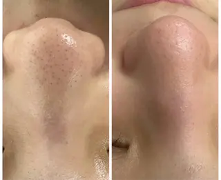 re.make所属・小顔美肌💖痩身☃️ ユキナ🤍のエステ・リラクイメージ