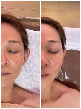 ロミロミ ・艶肌小顔 RIEのエステ・リラクイメージ