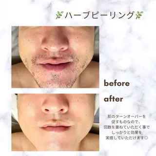 脱毛サロンFIS【新宿店】所属・堺 祐季奈のエステ・リラクイメージ