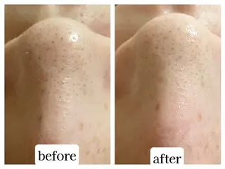 Eyebeauty 神コスパ×高技術❣️のエステ・リラクイメージ