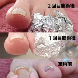 ネイル Micky nail chikushinoのその他イメージ