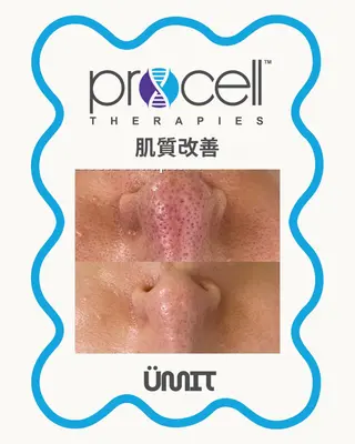 Ümit（ユミト） プロセルセラピーズのネイルデザイン