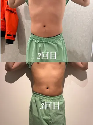 メンズ 腸活サポート みなみののエステ・リラクイメージ