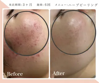 脱毛&フェイシャル 専門店muro.のエステ・リラクイメージ