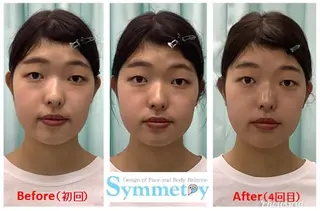 ネイル マツエク・マツパ 小顔・骨盤矯正専門店  シンメトリー池袋のエステ・リラクイメージ