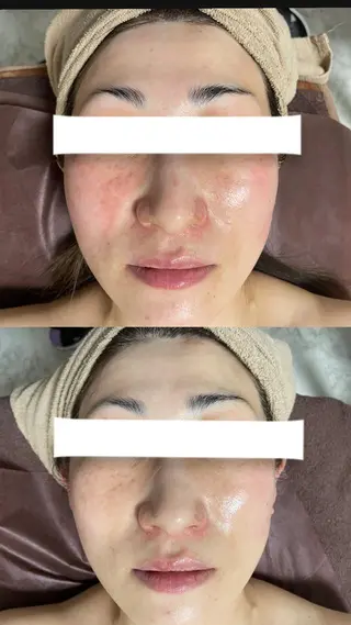 キッズ メンズ アイブロウ Epina 千葉店 【エピナ】のエステ・リラクイメージ