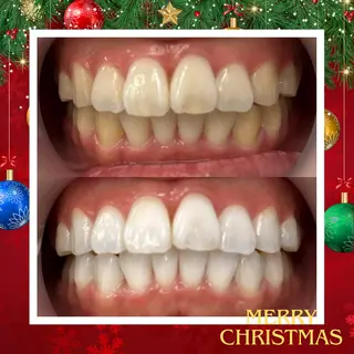 LBSホワイトニング上野店所属・LBSホワイトニング 🌐 上野店公式のエステ・リラクイメージ