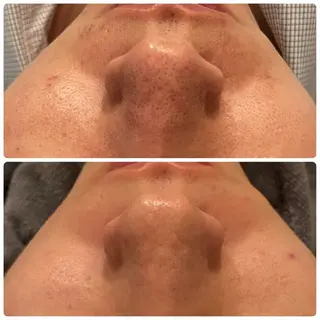 yellow.所属・yellow💛【 脱毛&フェイシャル】のエステ・リラクイメージ