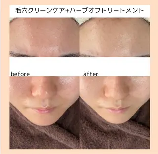 【three】毛穴/ 肌改善/小顔/耳ツボのエステ・リラクイメージ