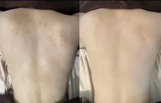 eto.所属・肌質改善サロンeto ニキビ・ニキビ跡のエステ・リラクイメージ