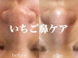 肌管理サロン neoriiのその他イメージ