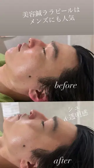 美容鍼灸サロン mahoroba院長のエステ・リラクイメージ