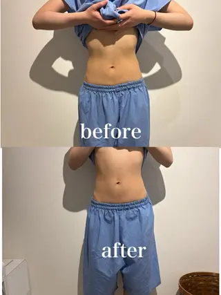 メンズ 腸活サポート みなみののエステ・リラクイメージ