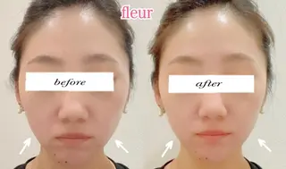 Fleur フルールのエステ・リラクイメージ