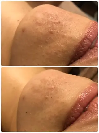 aimee　肌質改善サロン【アイミー】所属・肌質改善サロン aimee｜アイミーのエステ・リラクイメージ