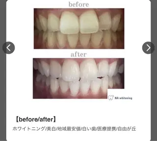 エミルカ　自由が丘店所属・ニキビ改善ハーブ🌿 ハナシマのその他イメージ